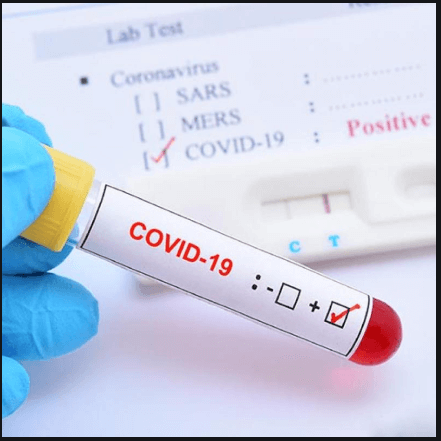 Covid Blood Test